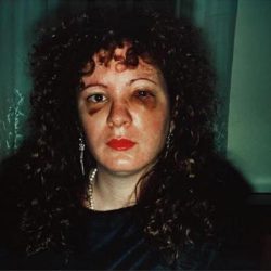 Nan goldin battered