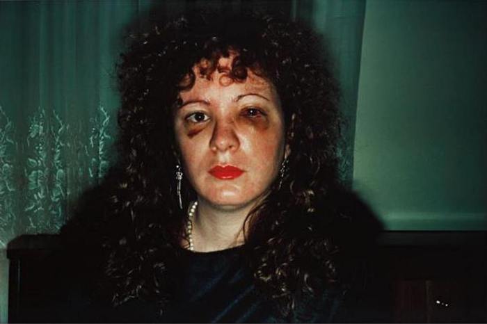 Nan goldin battered